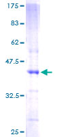 12.5% SDS-PAGE Stained with Coomassie Blue.